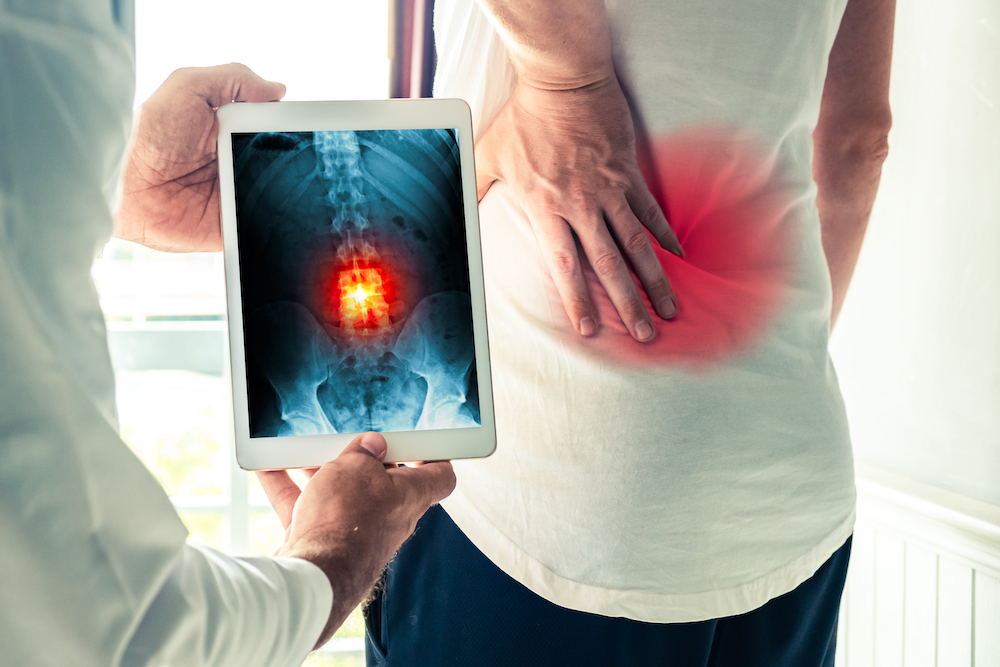 a doctor show to her patient the spine X-ray result